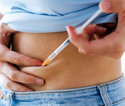 Wegovy Injections: What You Should Know Before Starting