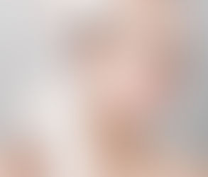 How Eyelid Surgery Can Improve Your Appearance