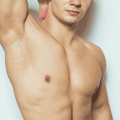 Gynecomastia Surgery in Muscat