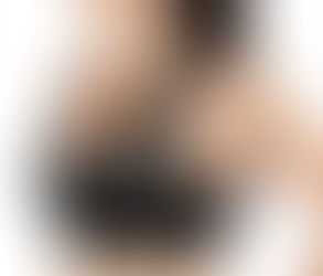 Can Breast Reduction Help Back Pain Relief?