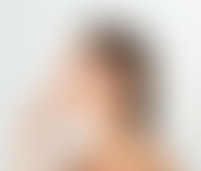 Choosing Between Local and General Anesthesia for Rhinoplasty