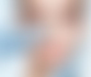 Understanding Rhinoplasty: What to Expect Before, During, and After the Procedure