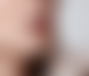 How to Fix Uneven Results After Lip Augmentation