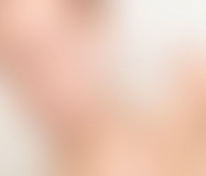 Rejuvenate Your Skin at Muscat's Best Skin Peels Clinics