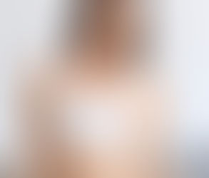 Is Traveling Abroad for Breast Augmentation Safe and Affordable?