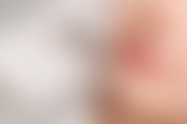 Achieve Your Dream Lips: The Ultimate Guide to Lip Fillers Clinics