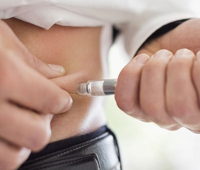 Wegovy Injection FAQ: Answers to Common Questions