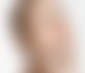 What Is Rhinoplasty and Why Do People Choose It?