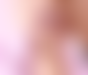 Does Lip Filler Affect How You Speak or Smile?