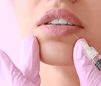 Does Lip Filler Affect How You Speak or Smile?