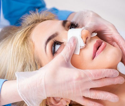 Anesthesia Options for Rhinoplasty Surgery Patients