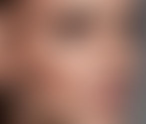 Preparing for Your First Plastic Surgery Consultation