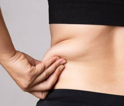 Best Candidates for Liposuction: Are You Eligible?