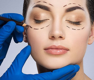 Eyelid Surgery Costs: What to Expect and How to Budget