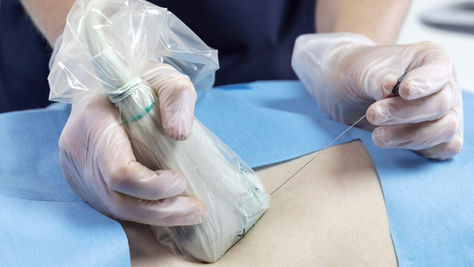 Hands-on Regional anesthesia Training Program