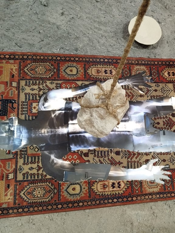 They have counted all my bones