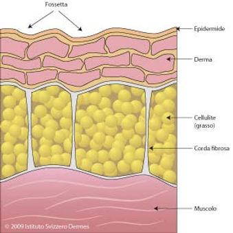 cellulite.jpg