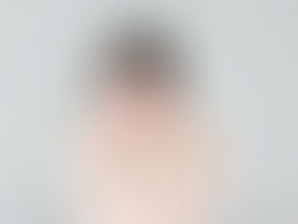 なぜホワイトニングをするべき?白い歯がもたらす驚きの効果とメリット