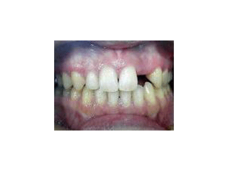治療例