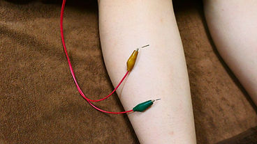 “歩行”に着目した足底板療法と継続調整