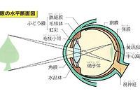 近視