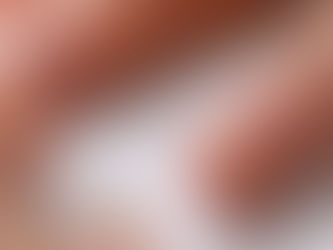 Toe Nail Fungus Removal Options