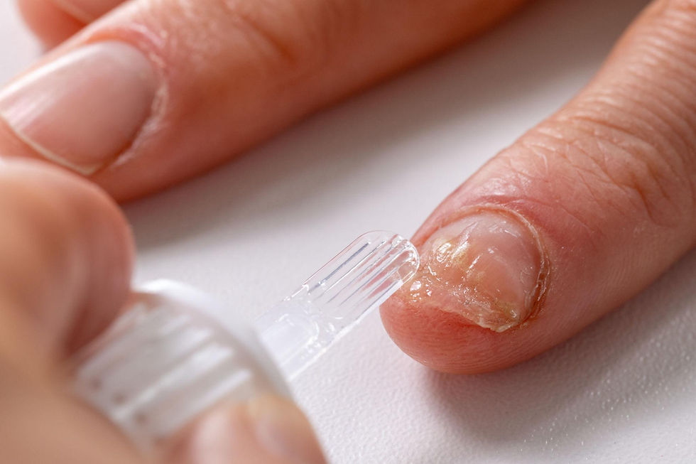 Toe Nail Fungus Removal Options