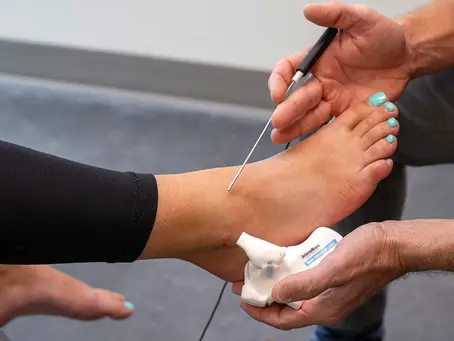 Foot and Ankle Surgery: Step-by-Step Guide