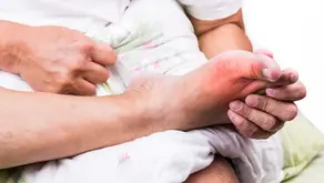 Foods That Trigger Gout Flare-Ups