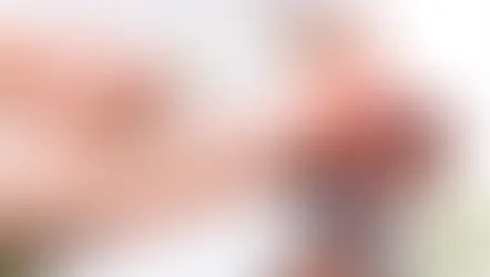 Foods That Trigger Gout Flare-Ups