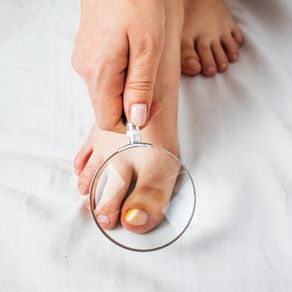 Hammer Toe: Effective Treatment Options