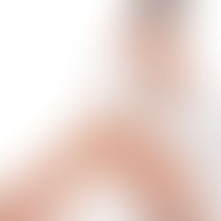 Láser o luz Pulsada IPL ? ¿Diferencias entre depilación láser y Fotodepilación?