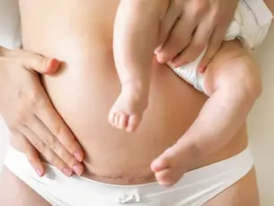 Colagenul aplicat extern poate ajuta la vindecarea cicatricilor sau vergeturilor?