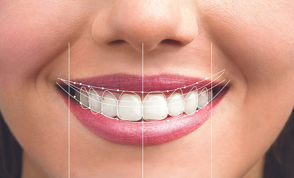 smile-design-by-sunny-dental.jpeg