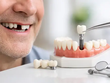 Missing Teeth Solutions for a Healthier Smile