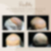17964008702653004.webp