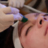 AQUA FACIAL
