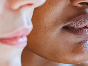 What Is Kybella and How Does It Work in 2025