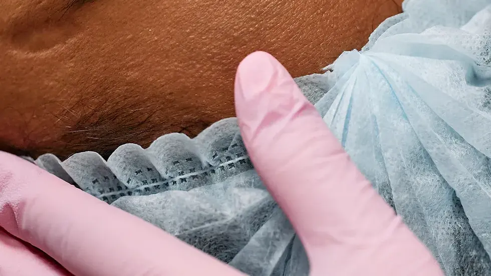 Why Botox Is the Go-To Choice for Waco Residents in 2025