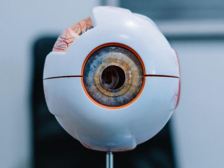 Teste de lentes de contato: como a oftalmologista escolhe o melhor modelo para você?