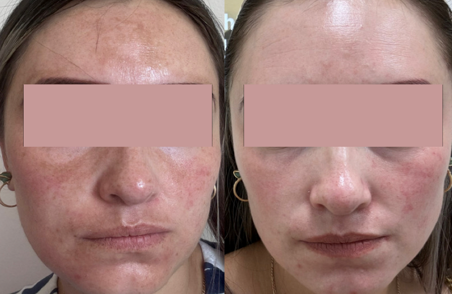 Before & After Photos