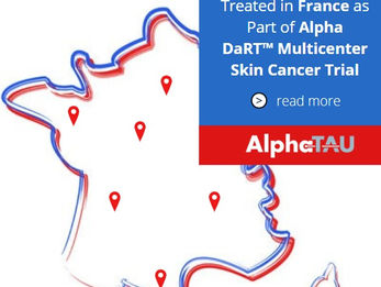 First Alpha DaRT Patients Treated in France as Part of Alpha DaRT™ Multicenter Skin Cancer Trial
