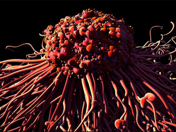 Israeli Company Set To Begin Testing New Radiation Cancer Therapy