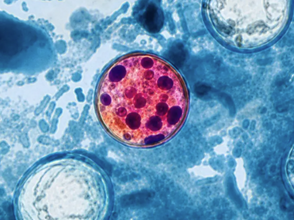 cyclospora image