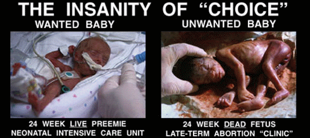 Abortion Images