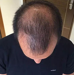 result1_before.jpg