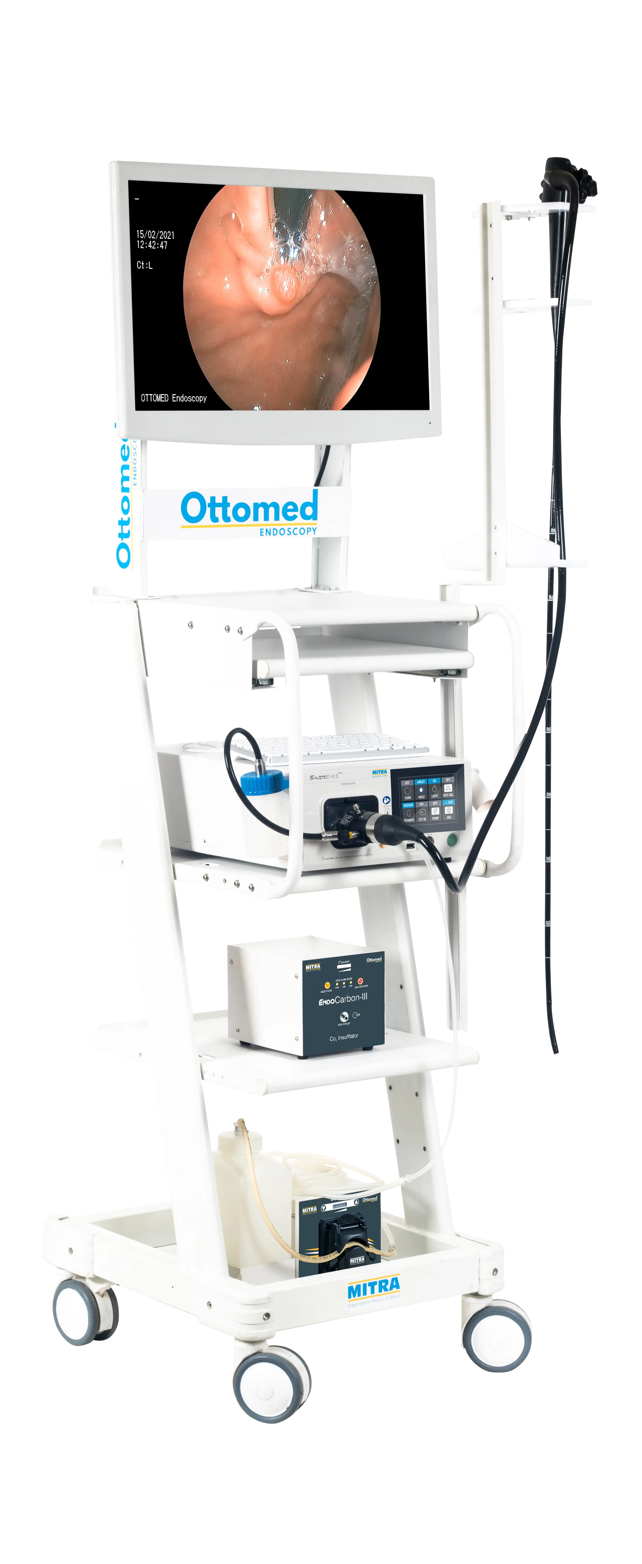Ottomed SmartEye II Plus Trolley Gastroenterology endoscopy system.webp