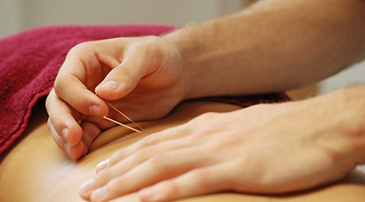 Acupuncture for back pain