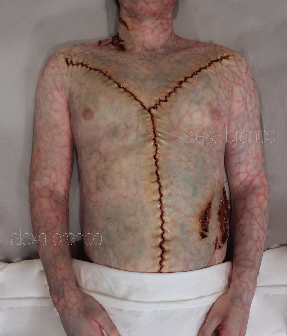 Cadaver