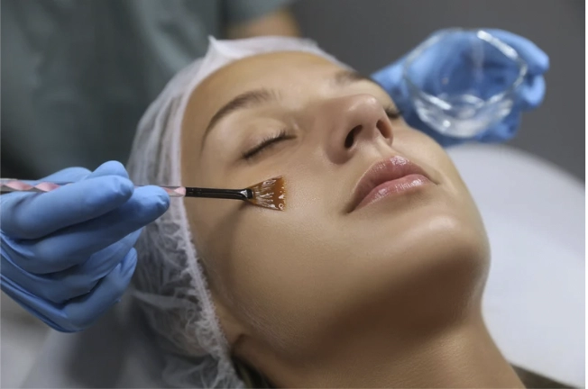 young woman getting a chemical peel